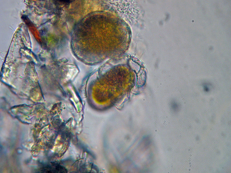 Dinoflagellato ?